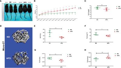 Gut Microbiota and Serum Metabolic Signatures of High-Fat-Induced Bone Loss in Mice